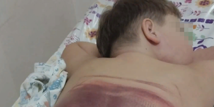 В аквапарке "Окская жемчужина" юного рязанца затянуло в систему фильтрации В аквапарке «Окская жемчужина» юного рязанца затянуло в систему фильтрации