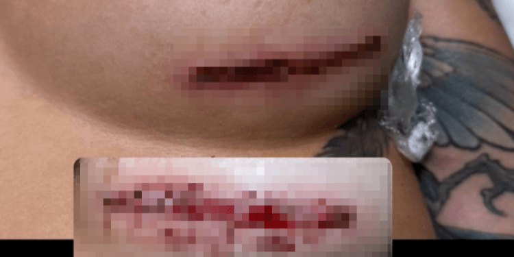 Участница телепроекта «Дом-2» Хромина пострадала от действий рязанских косметологов