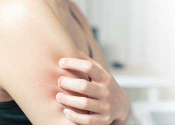 Из рязанских аптек пропал препарат от аллергии на пыльцу «Сталораль» Из рязанских аптек пропал препарат от аллергии на пыльцу «Сталораль»