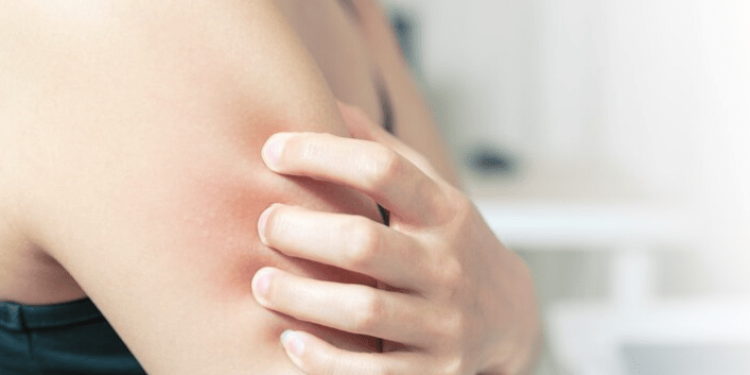 Из рязанских аптек пропал препарат от аллергии на пыльцу «Сталораль» Из рязанских аптек пропал препарат от аллергии на пыльцу «Сталораль»