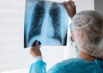 Здоровье рязанских школьников проверят на передвижном флюорографе Здоровье рязанских школьников проверят на передвижном флюорографе