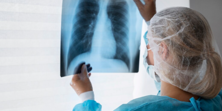 Здоровье рязанских школьников проверят на передвижном флюорографе Здоровье рязанских школьников проверят на передвижном флюорографе