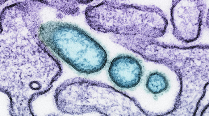 Роспотребнадзор рассказал рязанцев, как защититься от кишечной инфекции