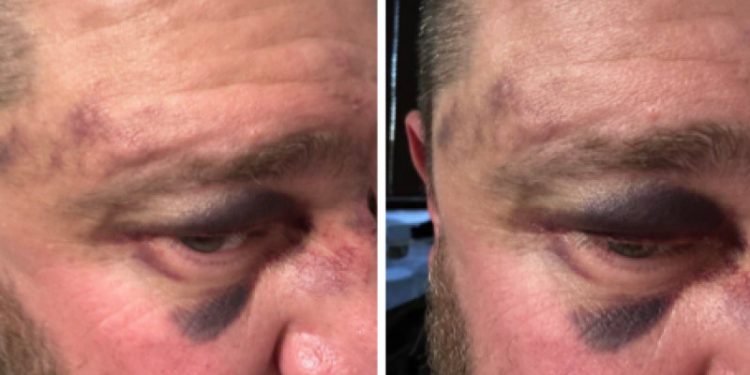 Рязанские полицейские проводят проверку после драки на стадионе "Спартак" Рязанские полицейские проводят проверку после драки на стадионе «Спартак»