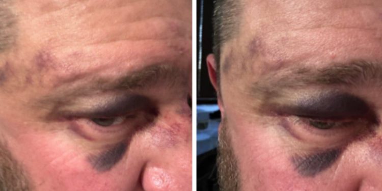 На рязанском стадионе «Спартак» произошла потасовка