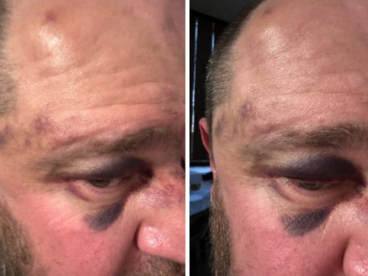 На рязанском стадионе "Спартак" произошла потасовка