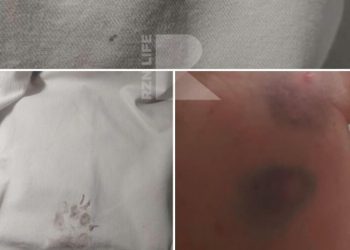 В Московском районе женщину искусала бездомная собака В Московском районе женщину искусала бездомная собака