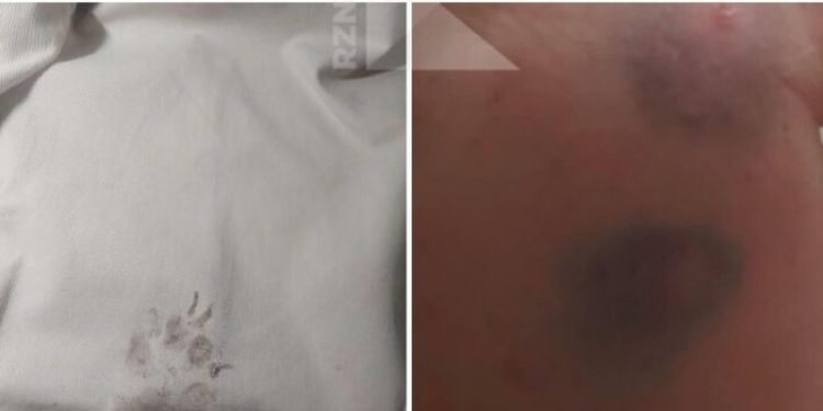 В Московском районе женщину искусала бездомная собака В Московском районе женщину искусала бездомная собака