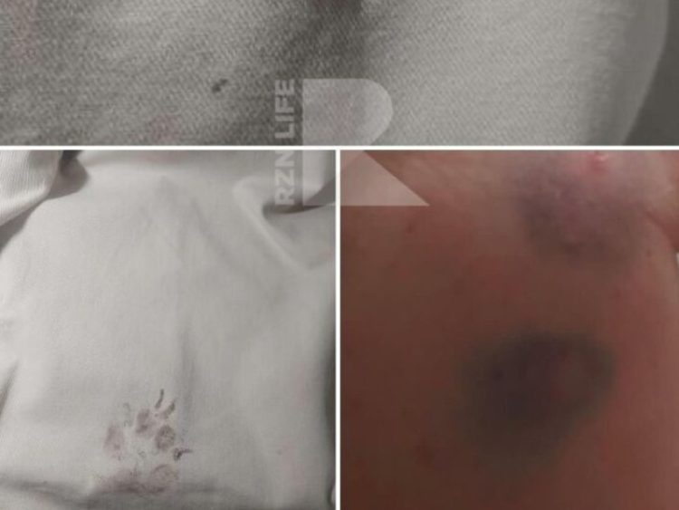 В Московском районе женщину искусала бездомная собака