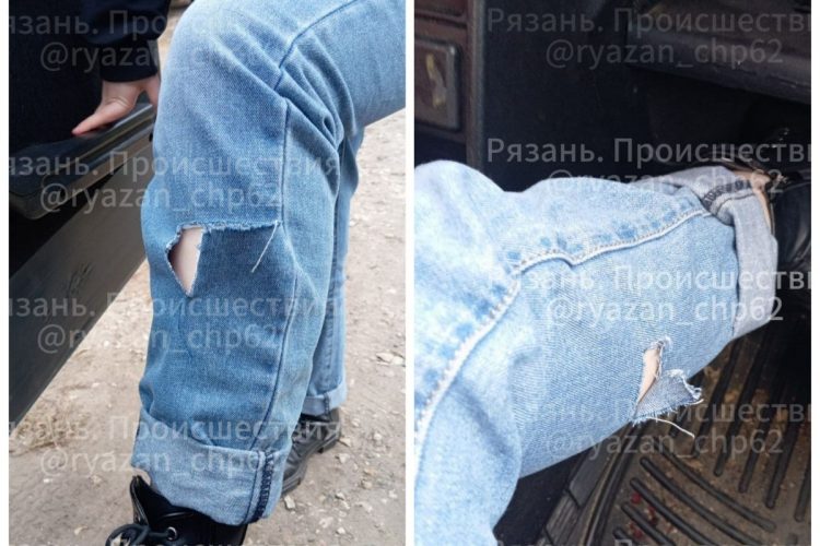 В рязанском Шацке девушку на местную жительницу напали три бездомные собаки