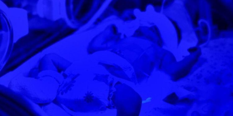 В Рязанском перинатальном центре на свет появился малышка с конфликтом по резус-фактору