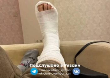 Рязанка сломала ногу на скользком тротуаре