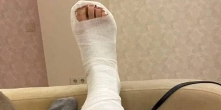 Рязанка сломала ногу на скользком тротуаре