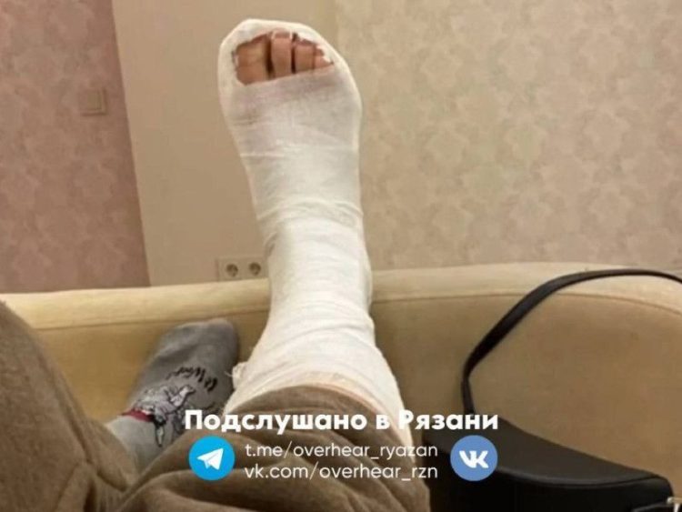 Рязанка сломала ногу на скользком тротуаре