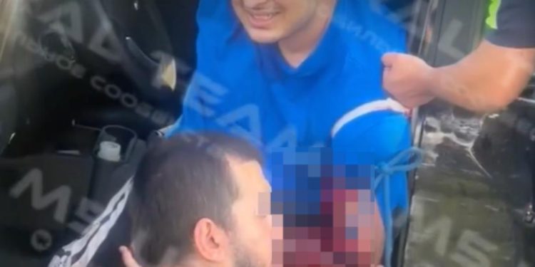 На трассе М-5 в Рязани водитель легковушки протаранил отбойник На трассе М-5 в Рязани водитель легковушки протаранил отбойник