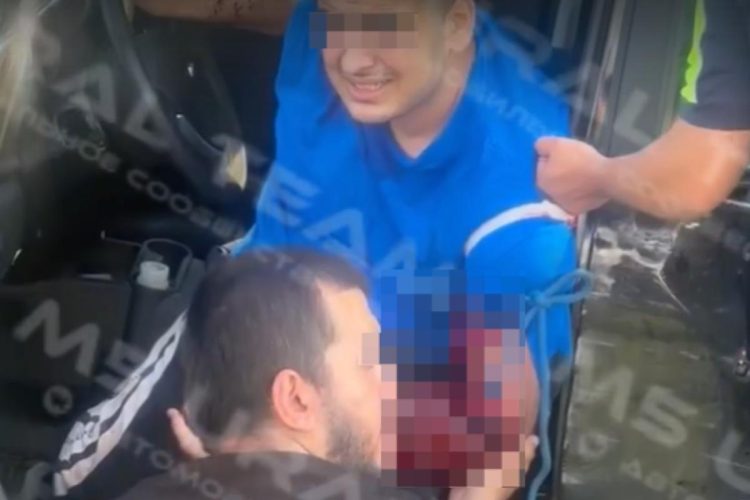 На трассе М-5 в Рязани водитель легковушки протаранил отбойник