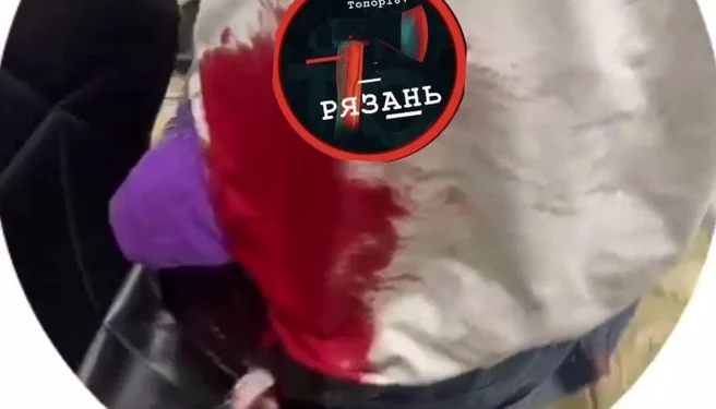 На улице Большой 15-летнего подростка ударили ножом в спину