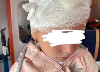 В рязанской Новопавловской роще качели рассекли голову маленькой девочке