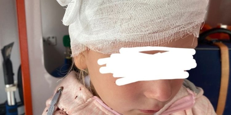 В рязанской Новопавловской роще качели рассекли голову маленькой девочке