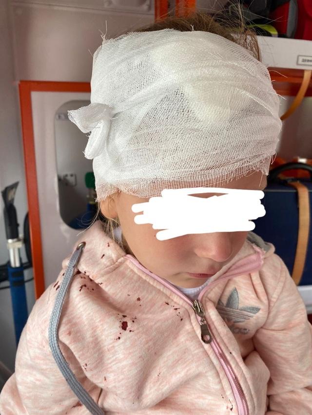 В рязанской Новопавловской роще качели рассекли голову маленькой девочке