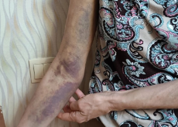 Полицейские, сломавшие руку рязанской учительнице, продолжают работать Полицейские, сломавшие руку рязанской учительнице, продолжают работать