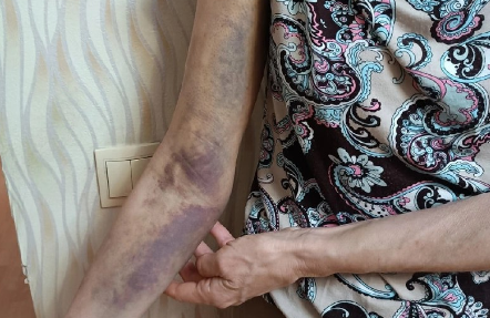 Полицейские, сломавшие руку рязанской учительнице, продолжают работать Полицейские, сломавшие руку рязанской учительнице, продолжают работать