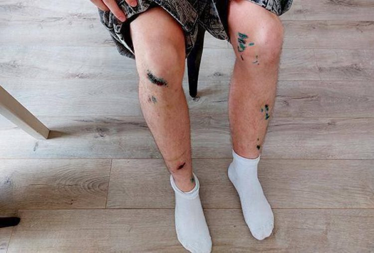 В районе рязанского ЦПКиО собаки покусали двух мужчин