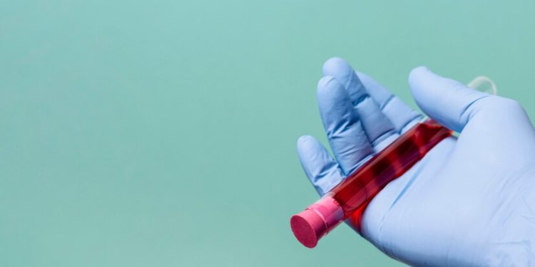 Рязанки пожаловались на подозрительную женщину, которая предлагает стать донором крови за деньги