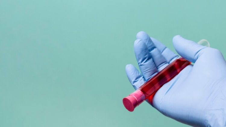 Рязанки пожаловались на подозрительную женщину, которая предлагает стать донором крови за деньги