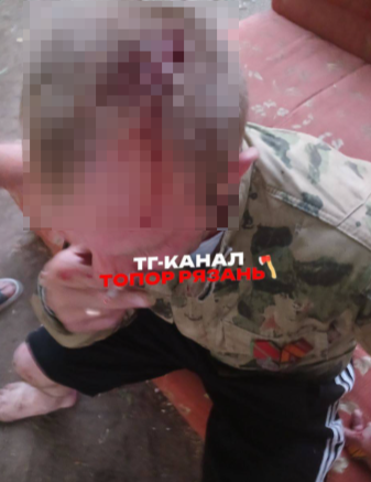 Рязанские подростки избили ветерана боевых действий